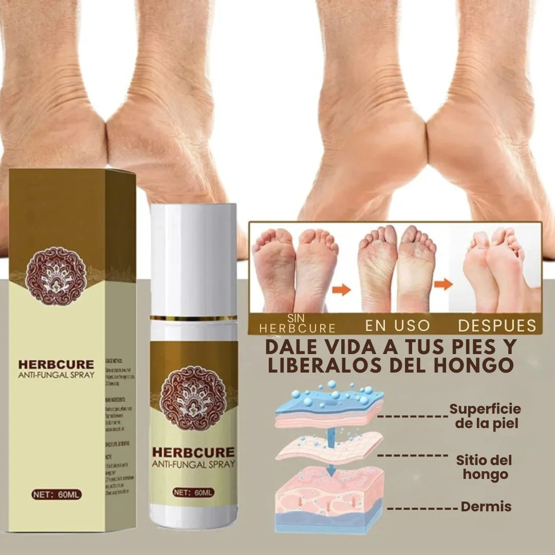 HERBCURE™ – Antifúngico 60ML