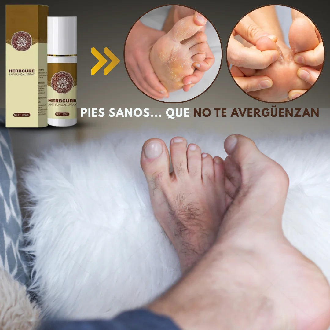 HERBCURE™ – Antifúngico 60ML