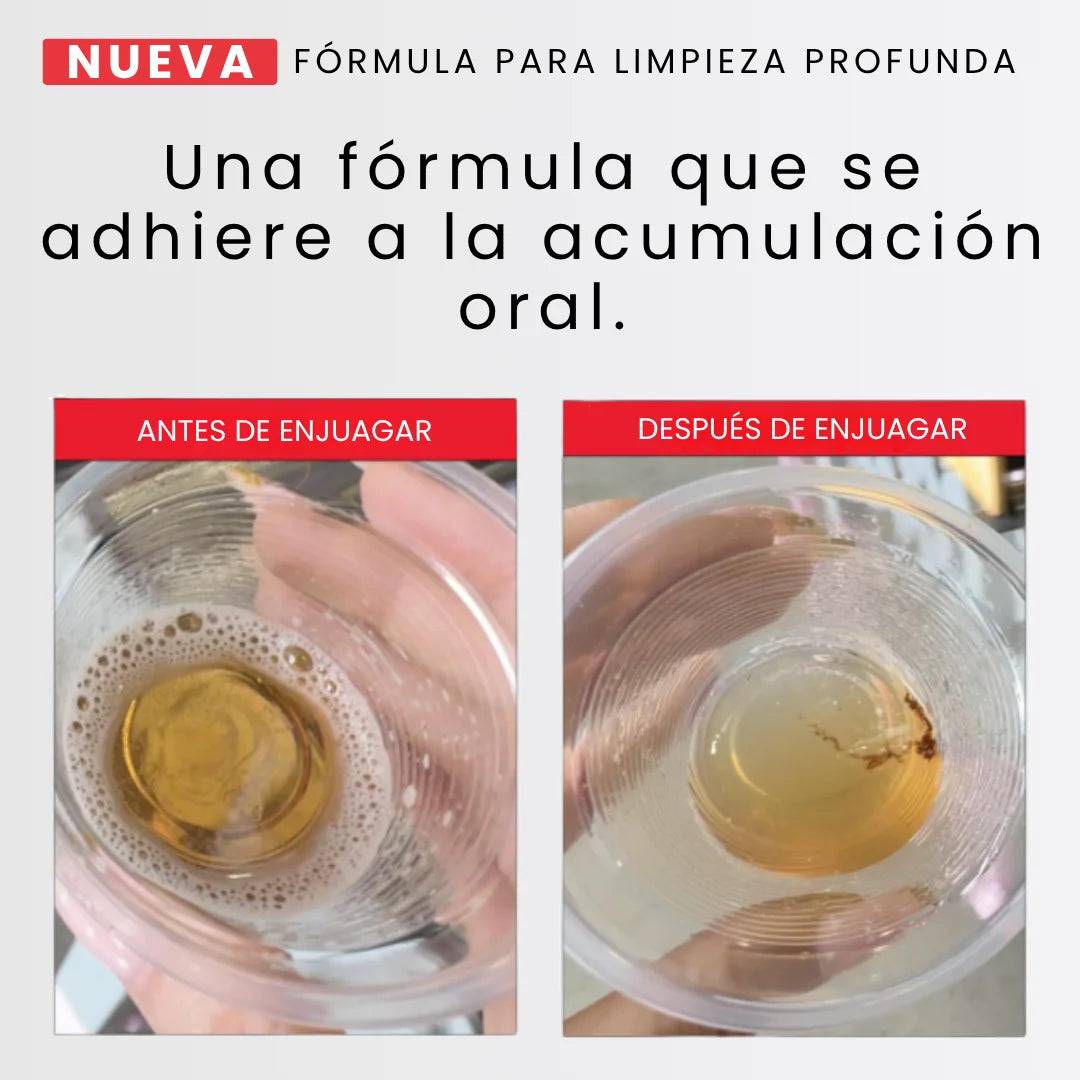 Enjuague bucal blanqueador dental avanzado